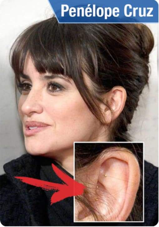 Auriculoterapia Penélope Cruz