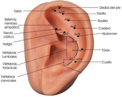 Auriculoterapia para Insomnio